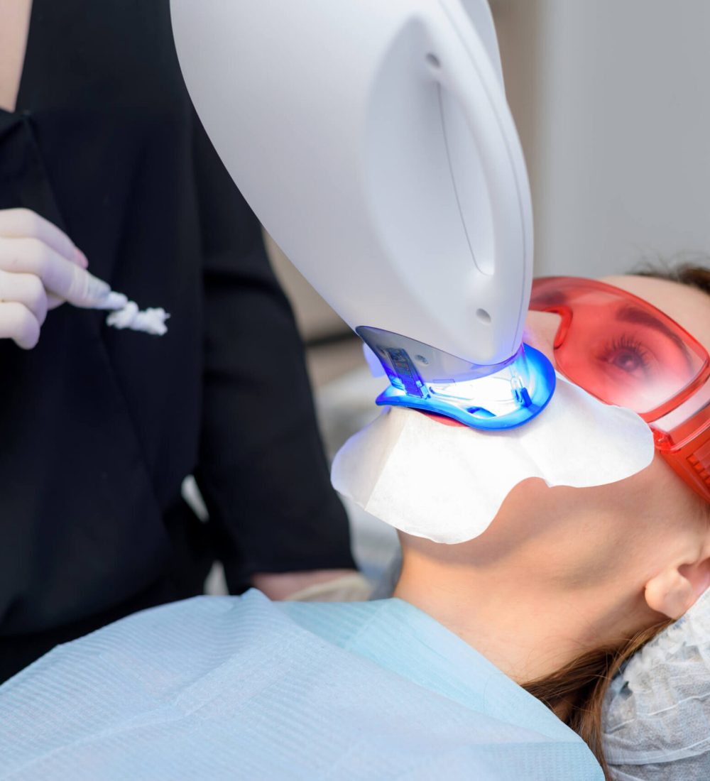 the-girl-undergoes-the-procedure-of-teeth-whitenin-2025-10-15-18-51-36-utc (1)