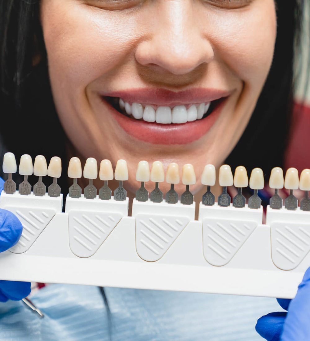 whitening-concept-dental-care-implants-veneers-2025-01-09-05-10-08-utc (1) (1)